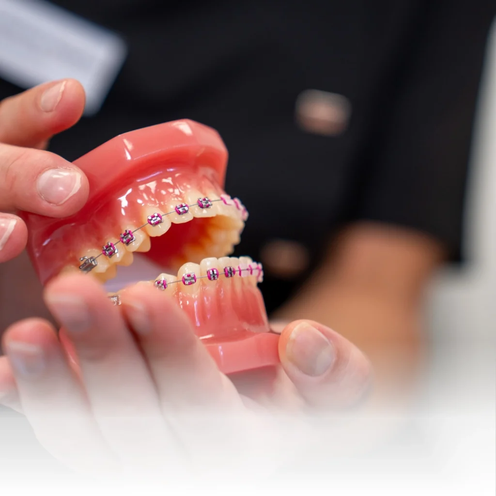 Apparecchio dentale a Verona
